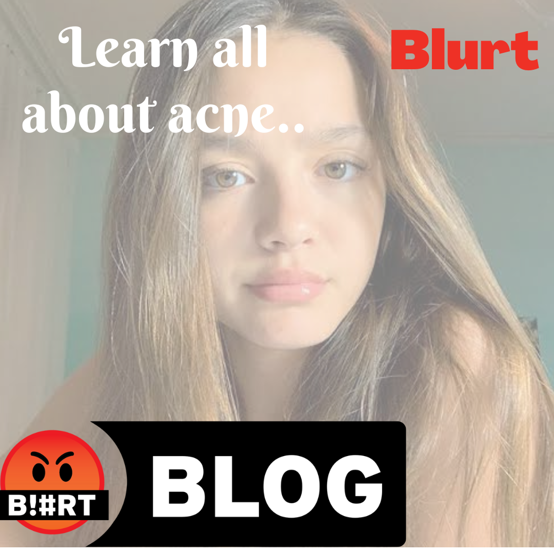 health-series-acne-symptoms-causes-risk-factors-diagnosis-and-treatment-blurt